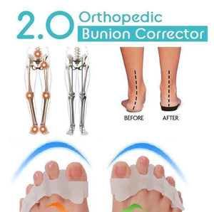 [EXCLUSIVE DISCOUNT] Orthopedic Bunion Corrector 2.0(1 PAIR)